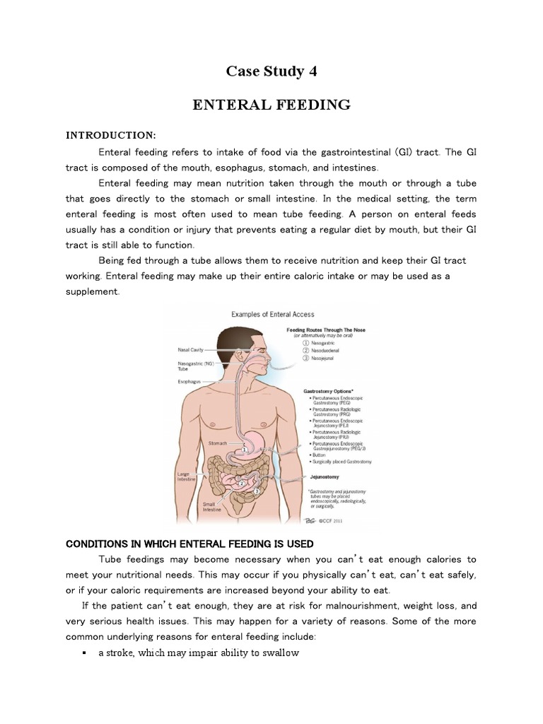 Case Study 4 Enteral Feeding | PDF