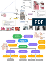 Enfisema pulmonar: clasificación, etiología y tratamiento