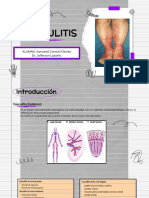 VASCULITIS