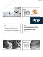 Apostila - Espondilólise e Espondilolistese