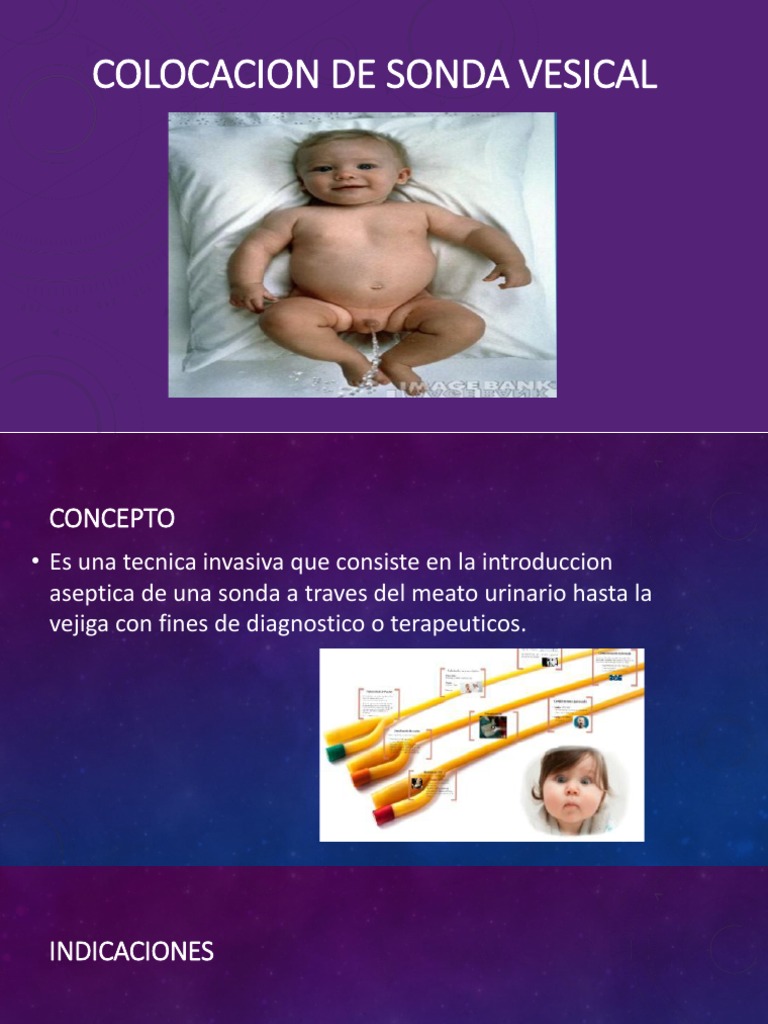 Colocacion de Sonda Vesical | PDF
