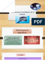 Alteración de Dentina