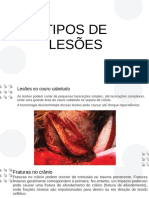 LCT - TIPOS DE LESÕES