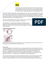 Glaucoma - MERCK