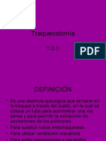 Traqueostomía