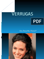 Verrugas Issste1.