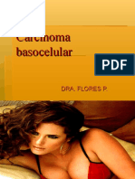 Ca basocelular3