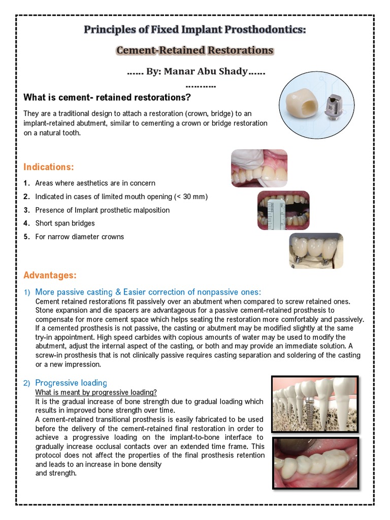Principles of Fixed Implant Prosthodontics PDF Dental Implant