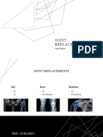 Joint Replacement - Inservice