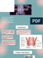 Fisura Anal Gastrocirugia FINAL