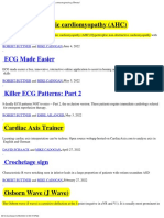 Apical Hypertrophic Cardiomyopathy (AHC) : Robert Buttner Mike Cadogan