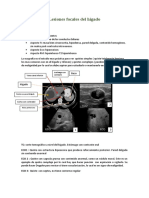 Lesiones hepáticas benignas TC