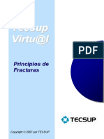 UD11 - Tipos de Fracturas