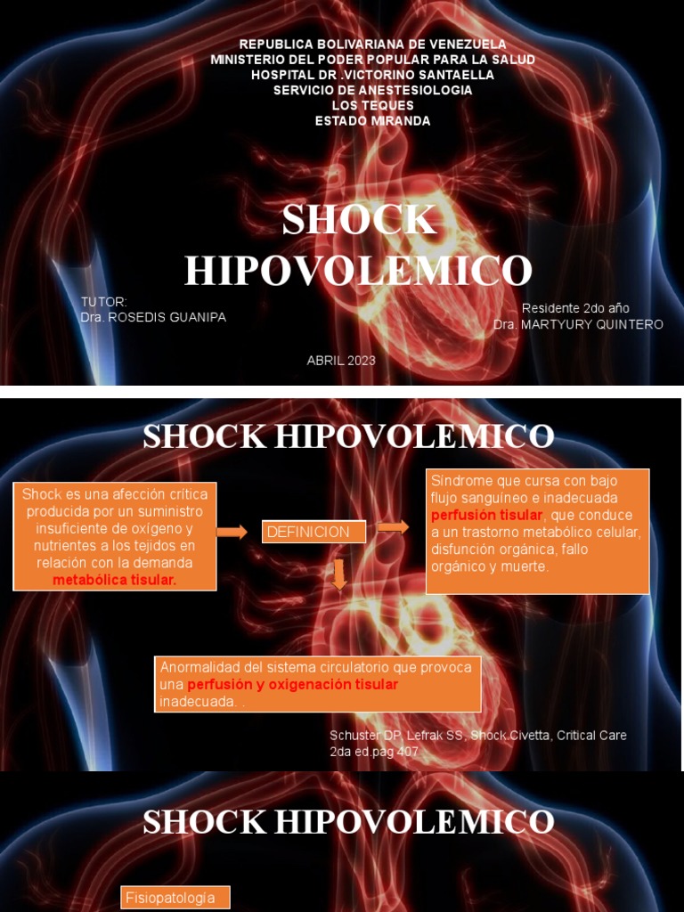 Choque Hipovolémico Fisiopatología Pdf – RTSRCJ