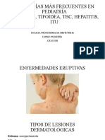 Patologías Más Frecuentes en Pediatría Eruptivas, Tifoidea, TBC, Hepatitis, ITU