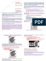 Enfisema Pulmonar