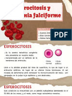 ESFEROCITOSIS Y ANEMIA FALCIFORME