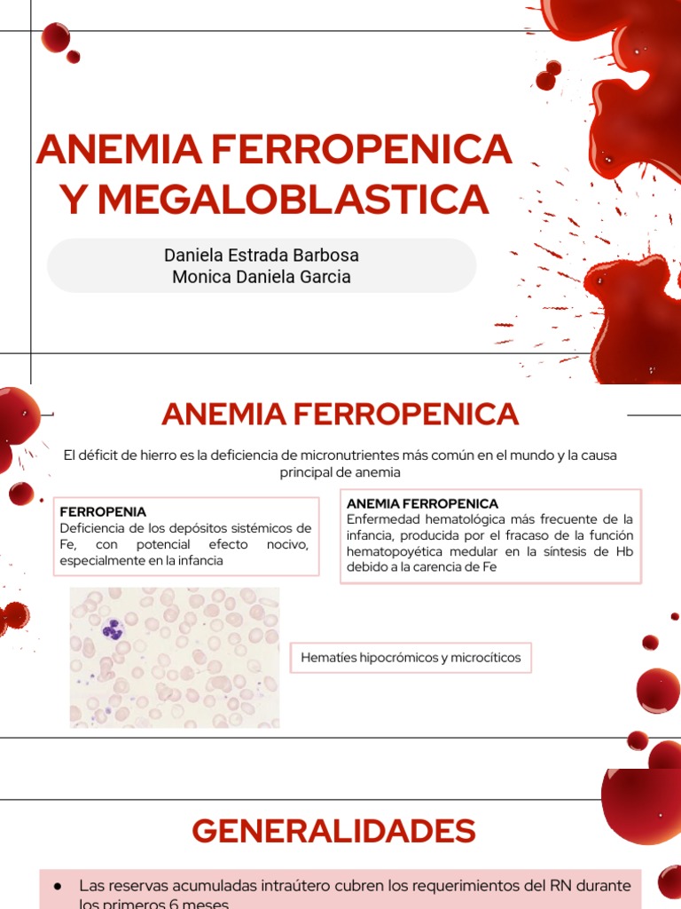 Anemia Ferropenica y Megaloblastica PDF Vitamina B12