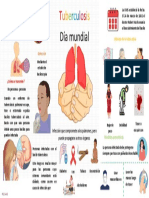 Tuberculosis: Enfermedad infecciosa causada por Mycobacterium tuberculosis