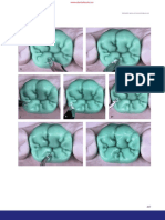 WWW - Dentalbooks.co: Primer Molar Mandibular