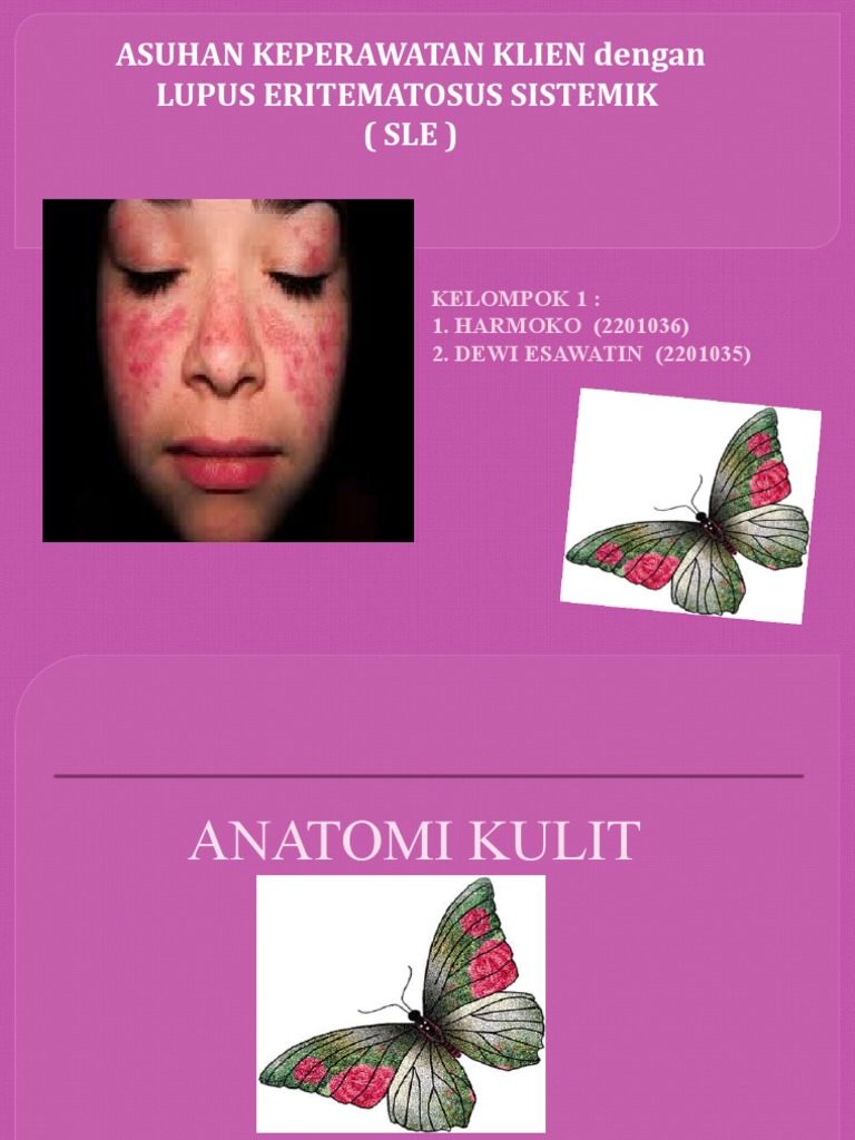 Askep sle kelompok 1 pdf