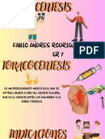 Toracocentesis