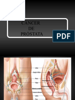 Cancer de Prostata