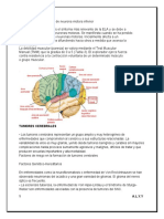 Síntomas y Signos de Neurona Motora Inferior