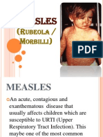 Measles