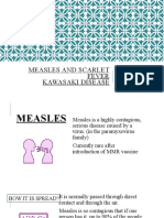 Measles and Scarlet Fever Kawasaki Disease: Fatin & Eileen