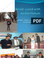 Uterine Fibroid Cured With Medorrhinum