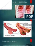 2 Pleurezia purulenta netubbzerculoasa