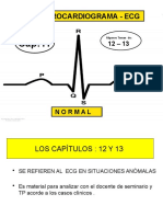 Electrocardiograma - Ecg: Algunos Temas de