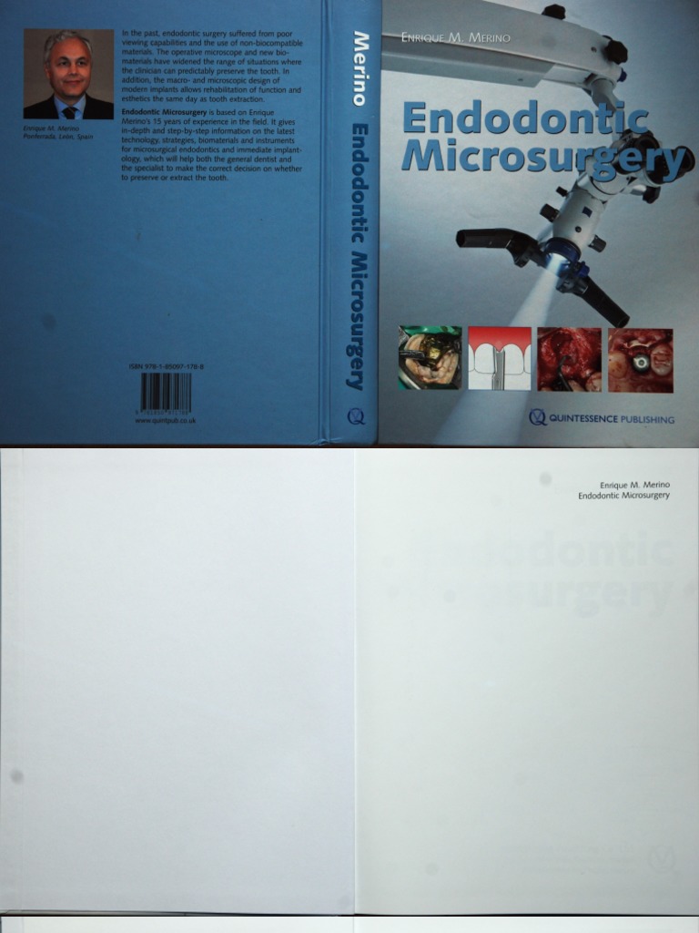 Ca. Ca.1b1h1tles | PDF | Dental Implant | Surgery