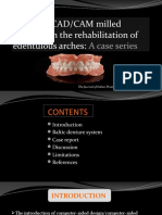 Two-Visit CAD/CAM Milled Dentures in The Rehabilitation of Edentulous Arches