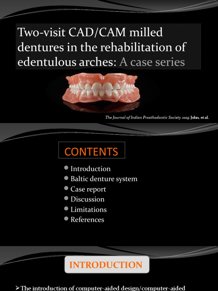 Two-Visit CAD/CAM Milled Dentures in The Rehabilitation of Edentulous ...