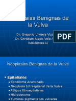 Neoplasias benignas vulvares: diagnóstico y tratamiento