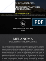 Melanoma y condrosarcoma piel
