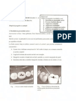 Cariologie Cav Cls 1