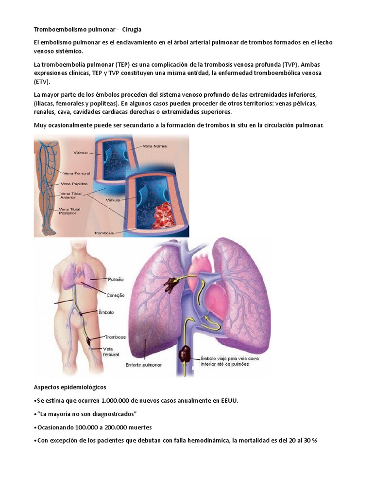 Tratamiento y diagnóstico del TEP | PDF | Medicina | Sistema cardiovascular