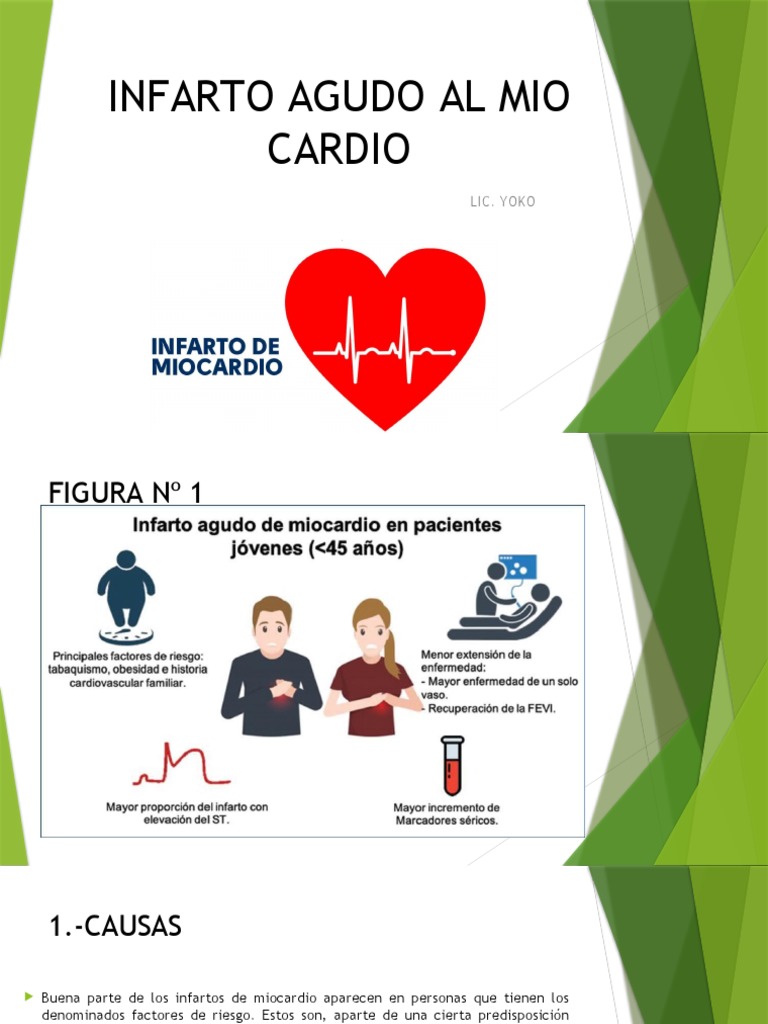 Manejo del Infarto Agudo de Miocardio | PDF | Infarto de miocardio ...