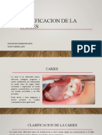 Caries: clasificación según grado de evolución, tejidos afectados y superficies