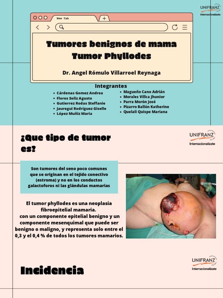 TUMOR PHYLLODES PRESENTACION GRUPO ANENCEFALICOS PDF