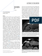 Extrahepatic Biloma Imaging Pitfall