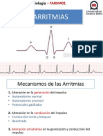 Arritmias