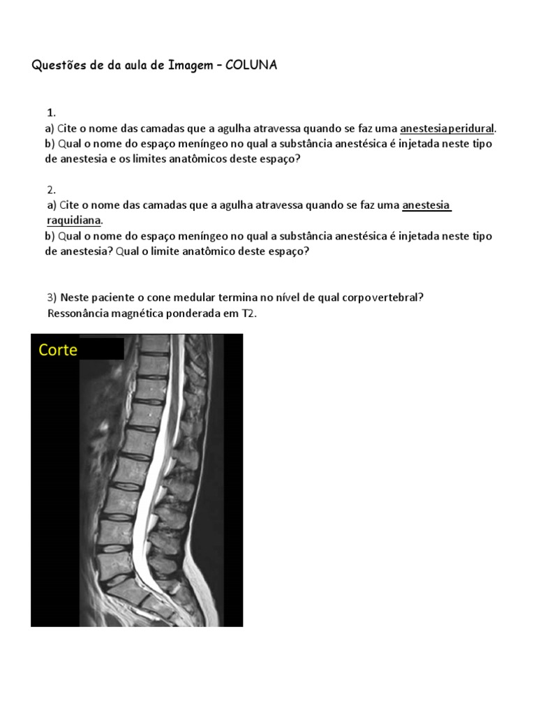 Anestesia e Anatomia da Coluna Vertebral | PDF | Métodos e Materiais de ...