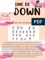 Ejemplo Sindrome de Down