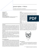 2. Zygomatic implants - a review