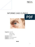 Caso Clinico Glaucoma