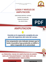 Etiologia y Niveles de Amputacion